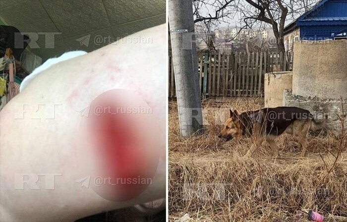 В приморском Артёме собака напала на женщину с двумя детьми и попыталась укусить шестилетнюю девочку за голову