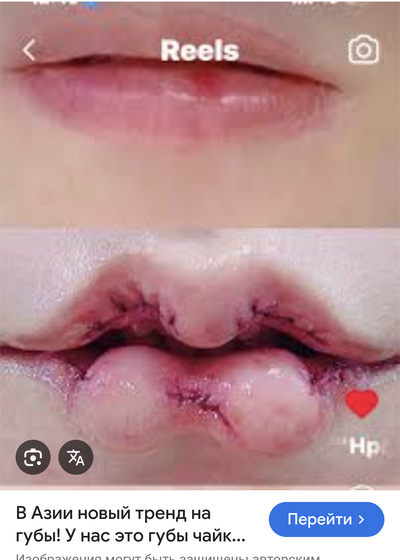 Иллюстрация к комментарию