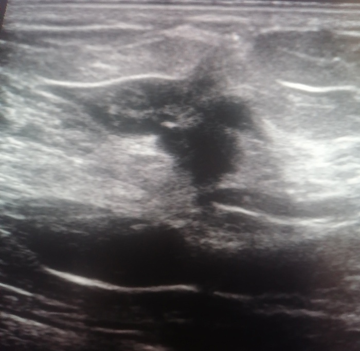 �� ����� �������� � �������