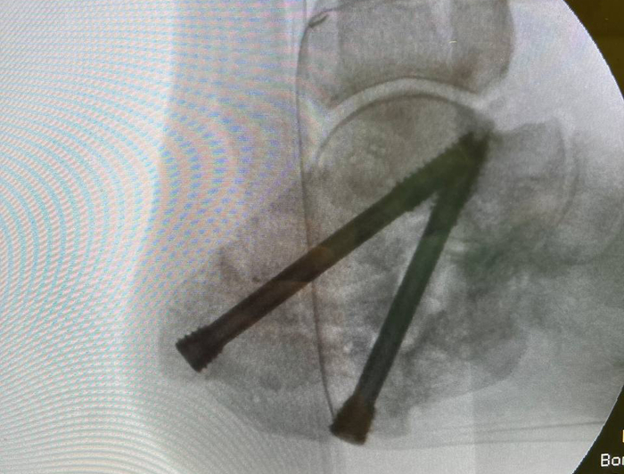 ������������� ���.