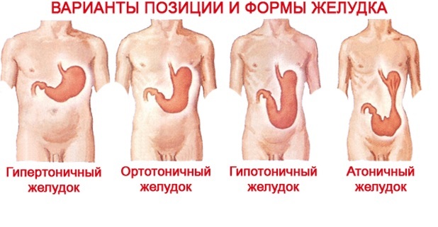  3  , , , , , , , , , , 