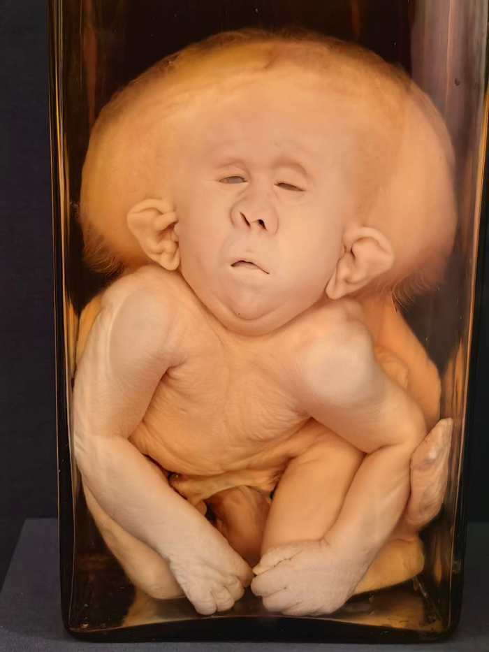 ? ?, 