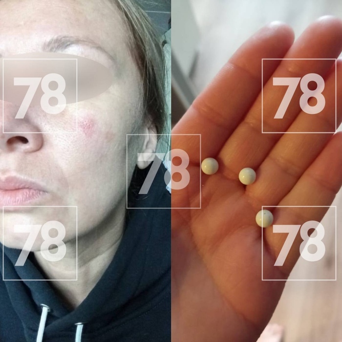 В Кудрово мужчина с балкона обстрелял собачницу после ссоры из-за выгула собак на футбольном поле