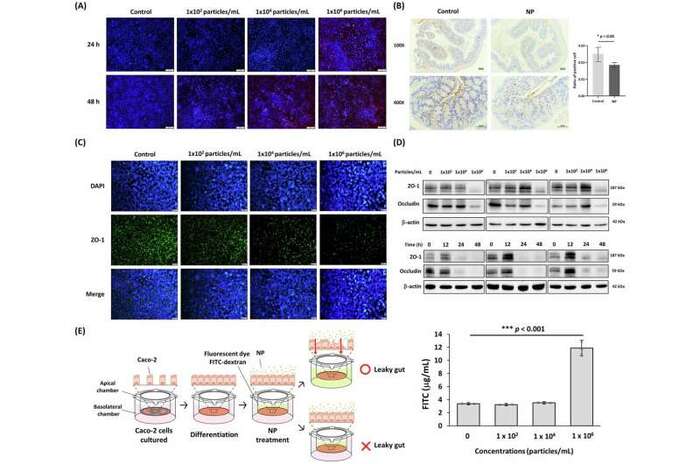 Влияние НП на барьерную функцию кишечника.