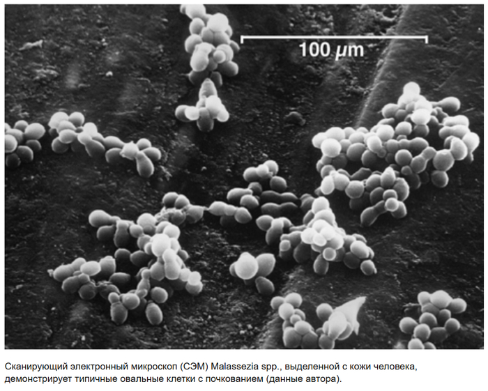 Дочерняя клетка, отделяясь, оставляет рубец в виде воротничка, через который появляются последующие дочерние клетки. В результате клетка приобретает характерную форму в виде груши или лампочки