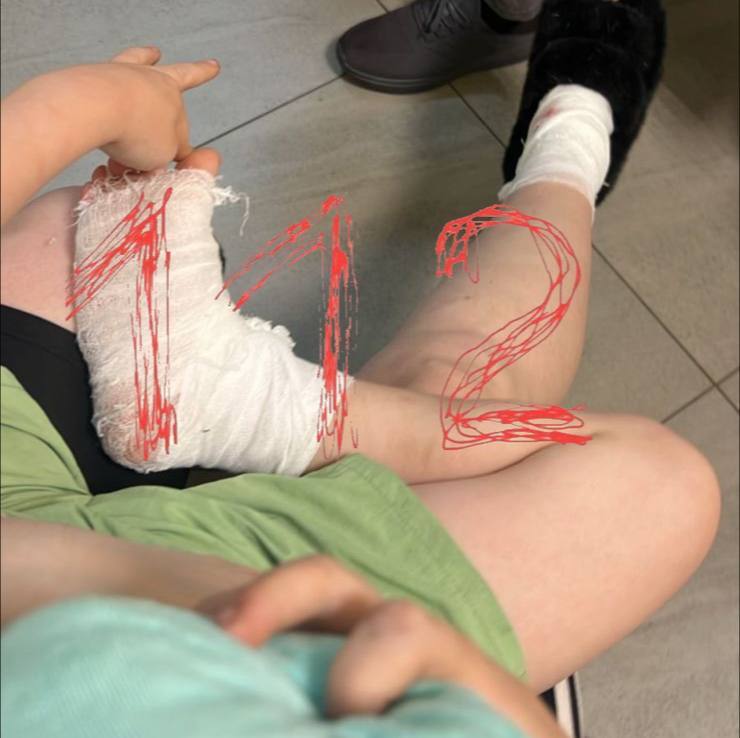 Owner Sets Pitbull on Woman and Child in Primorye - Dog attack, Dog lovers, Negative, Incident, Dog, Attack, Fighting dog, Pitbull, No muzzle, Dog bite, Primorsky Krai, Vladivostok, Video, Vertical video, Short videos, Telegram (link), Longpost