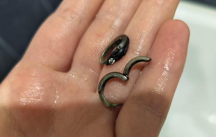 Серебро чернеет на теле