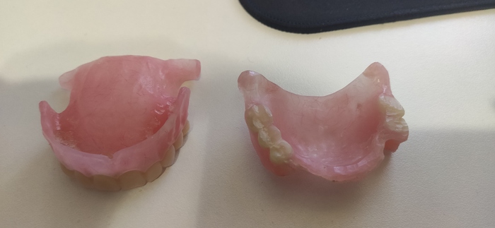 Вот два съёмника на память, левый вроде низ, правый вверх.