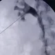 Аватар пользователя PiskinDoctor49