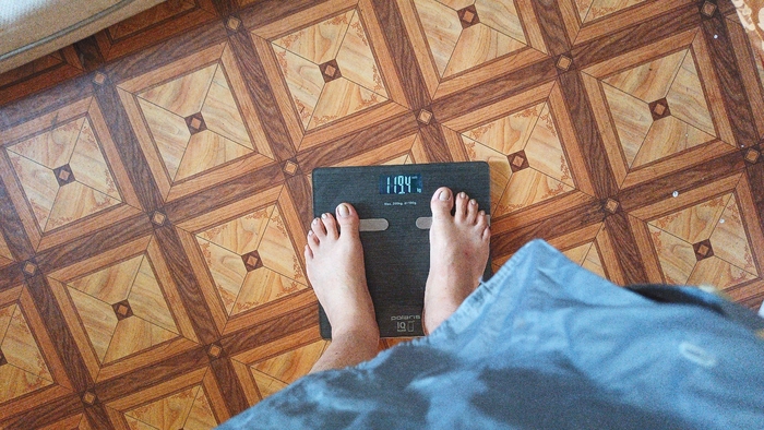 С 310 кг до 119 кг за 19 месяцев. Личный опыт Хирургия, Лечение, Длиннопост