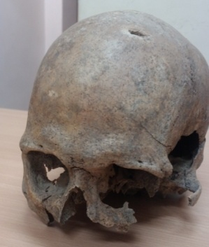 Череп со следами ударов