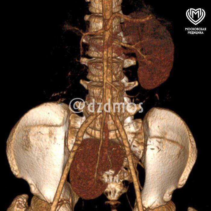   &quot;&quot;  :    15   