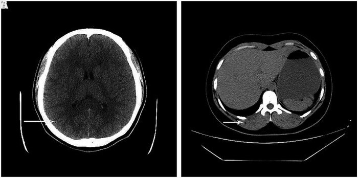 Figure 1. (A  B)       ( 2017 .)            