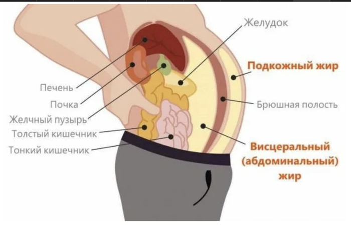 Липосакцией убирается только подкожный жир.