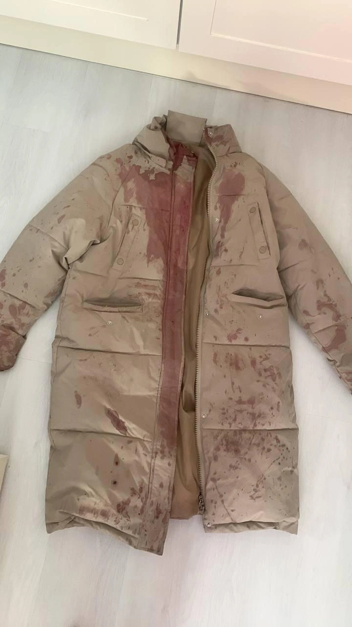 Насильник-убийца сломал нос даме за отказ целоваться