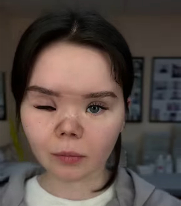 <a href="https://pikabu.ru/story/odnim_glazkom_13337788?u=https%3A%2F%2Fpikabu.ru%2Fstory%2Fprotez_gde_13337556%3Futm_source%3Dlinkshare%26utm_medium%3Dsharing&t=%D0%9F%D1%80%D0%BE%D1%82%D0%B5%D0%B7%20%D0%B3%D0%B4%D0%B5%3F&h=210e5231909dbb5304ef0f04ae8f9a33efb3e886" title="https://pikabu.ru/story/protez_gde_13337556?utm_source=linkshare&utm_medium=sharing" target="_blank">Протез где?</a>
