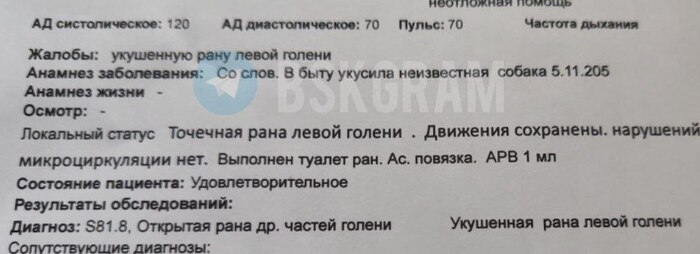 Стая собак напала на ребенка в Бийске