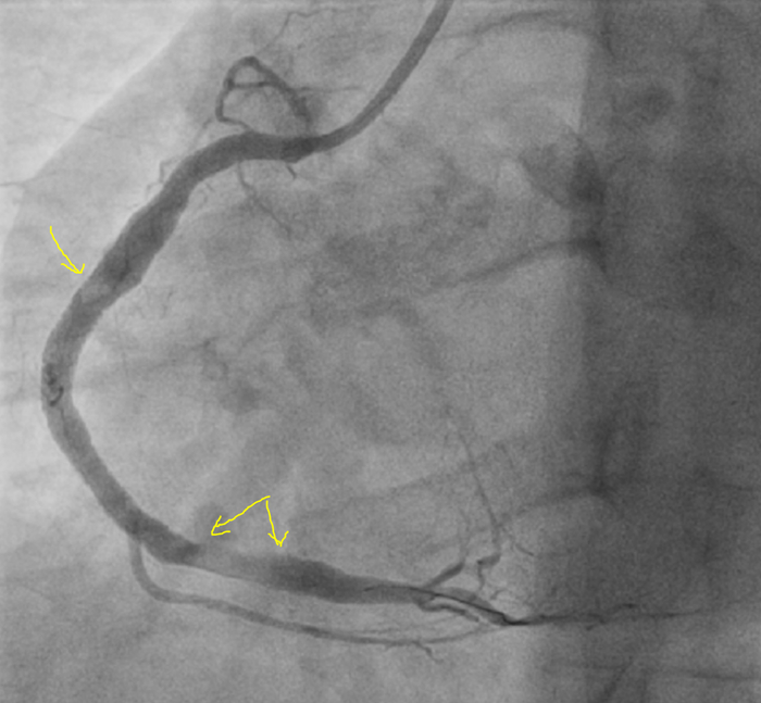      (      "" -  ,     )