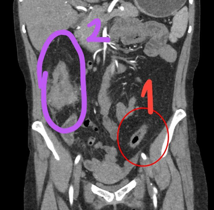 1 - -   , 2 -  (   )