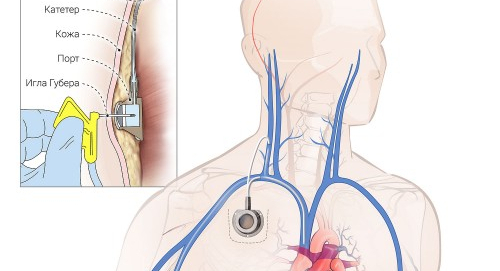 У меня такой вариант порта, есть и другие