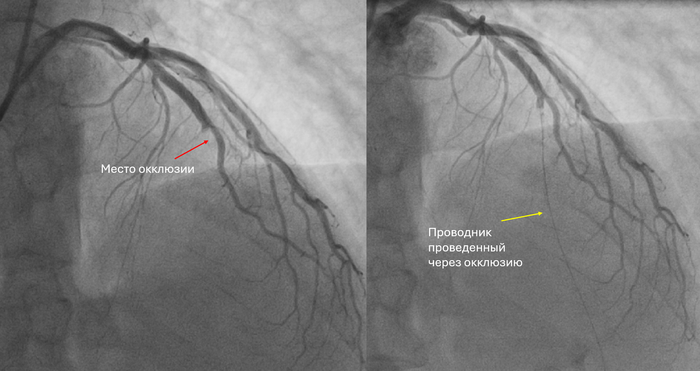 �������� ���������� �������, ��������� ������������� ����� ��������� ����������� �����������