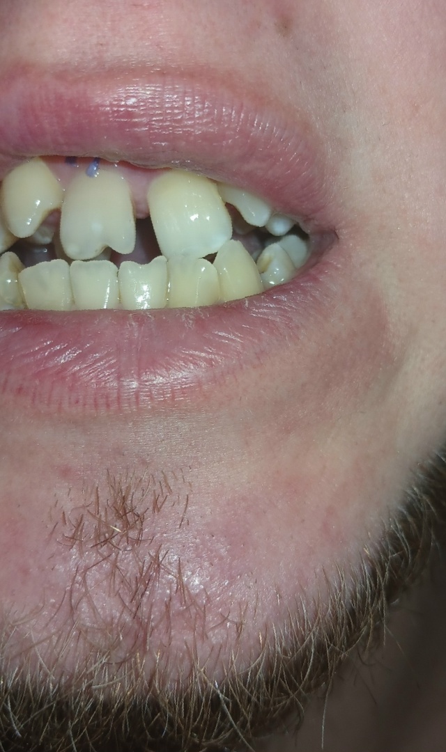 Это то, как сейчас.