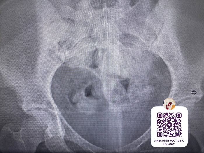 ��������� ���� �������� ������