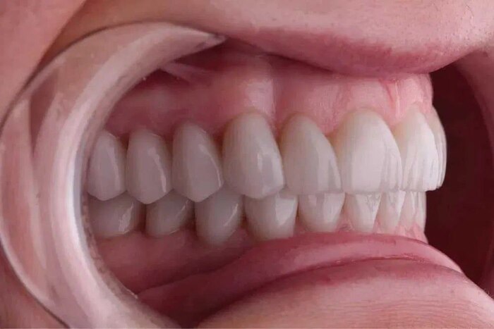 ��� ��������������. �� ��� � ��� �����, �����������(��). � ������ ��� �������, ������ ��� ���� ������� �������� � ������� ������... �������� ���� ������.