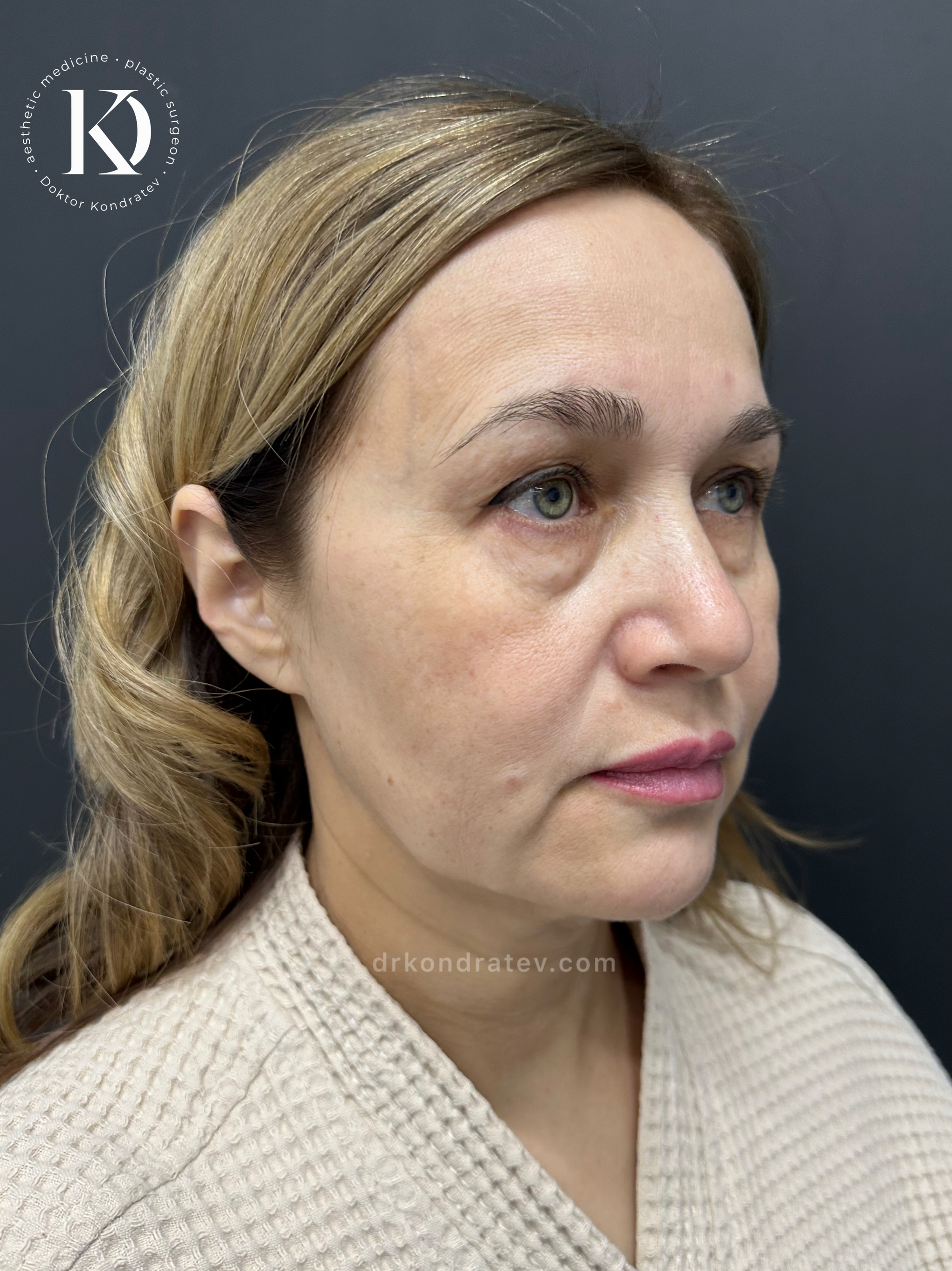 How to restore your original face without signs of overtightening? - My, Face, Facelift, Blepharoplasty, Video, Vertical video, Short videos, Longpost