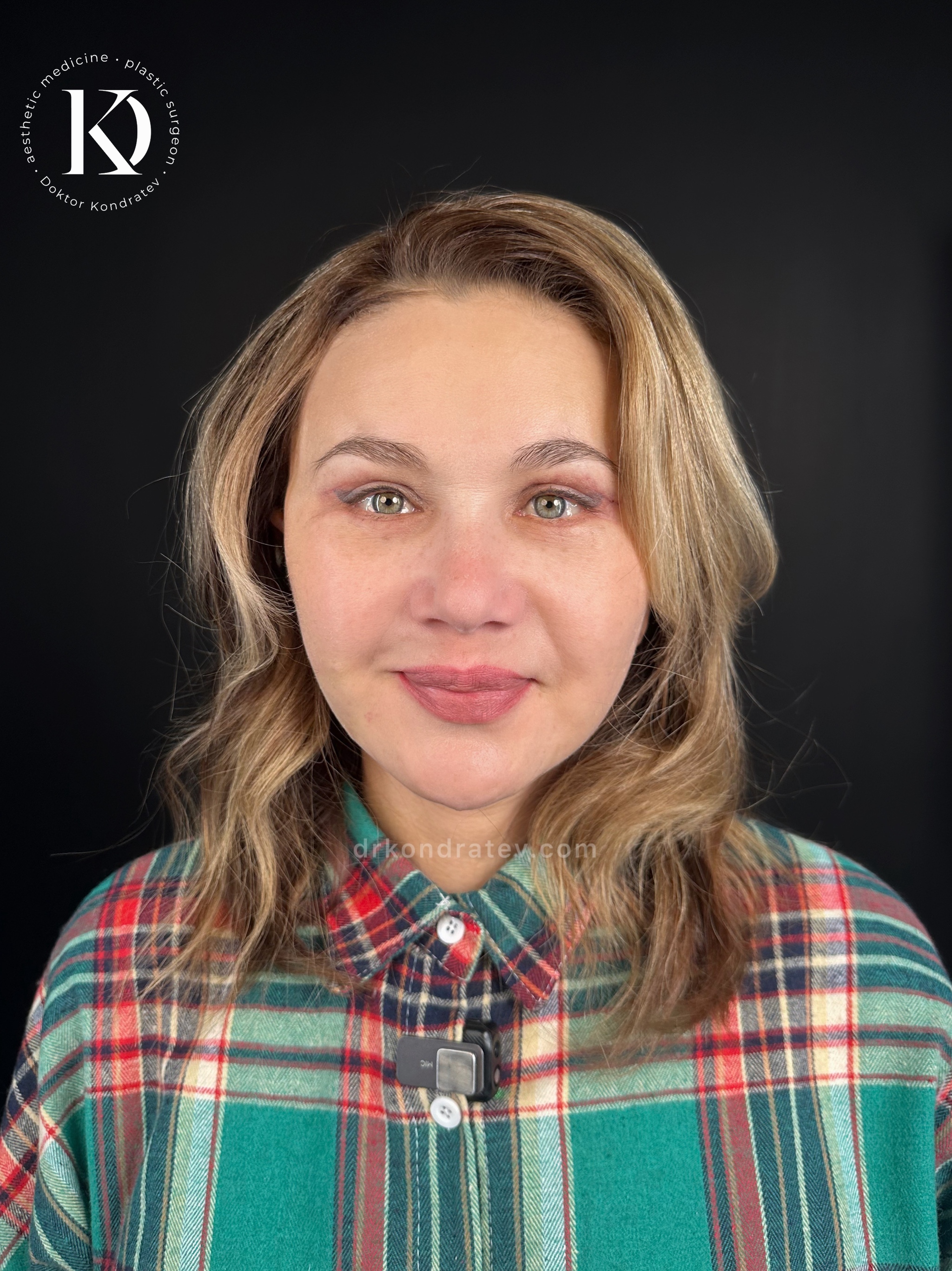 How to restore your original face without signs of overtightening? - My, Face, Facelift, Blepharoplasty, Video, Vertical video, Short videos, Longpost
