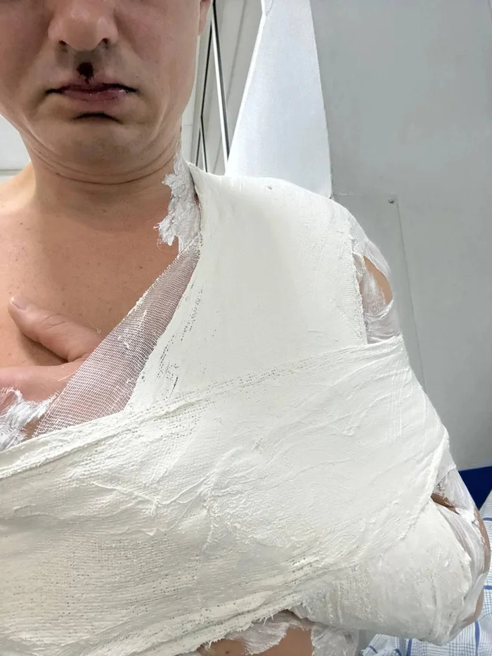 <!--noindex--><a href="https://pikabu.ru/story/otvet_na_post_tyumentsa_zhestoko_izbili_izza_konflikta_na_detskoy_ploshchadke_13607400?u=https%3A%2F%2F72.ru%2Ftext%2Fincidents%2F2026%2F01%2F11%2F76210453%2F&t=https%3A%2F%2F72.ru%2Ftext%2Fincidents%2F2026%2F01%2F11%2F76210453%2F&h=1783cb2836fd47c1eea4ce205139fbd42bb26b47" title="https://72.ru/text/incidents/2026/01/11/76210453/" target="_blank" rel="nofollow noopener">https://72.ru/text/incidents/2026/01/11/76210453/</a><!--/noindex-->