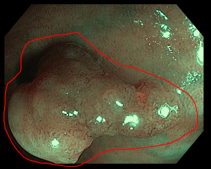 ��� ��� �������� ��� ����� (( - ���� �� �������