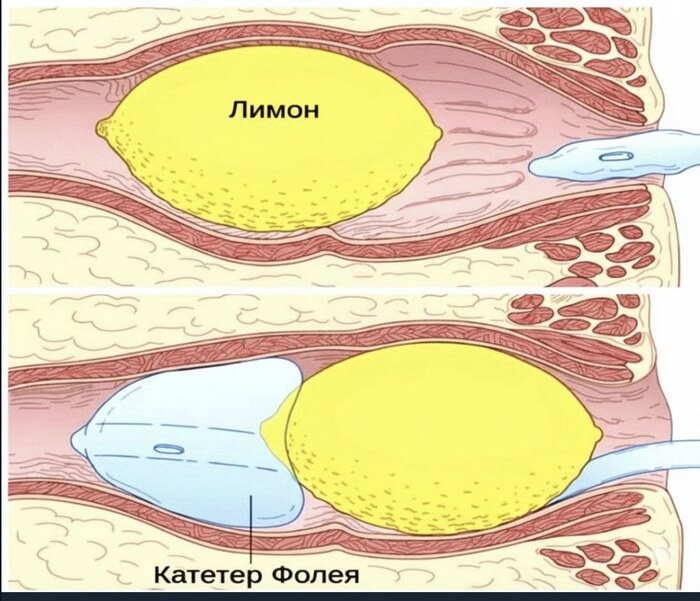 ��� � �������, �������?