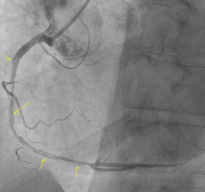 ��������� ����� ��������� ������ ������ + ����� ������ �������