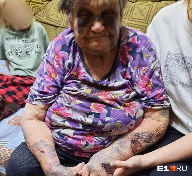 ������� ����� ������ ������ ����� �������� ��������: �������� <!--noindex--><a href="https://pikabu.ru/story/pryigala_na_spine_tolkala_tryapku_v_rot_na_urale_babushku_izbili_v_ee_zhe_dome__ona_umerla_a_vinovnik_ne_ustanovlen_13726844?u=http%3A%2F%2FE1.RU&t=E1.RU&h=d14cb2f4849bc246a517d6332b909846dc263a36" title="http://E1.RU" target="_blank" rel="nofollow noopener">E1.RU</a><!--/noindex-->