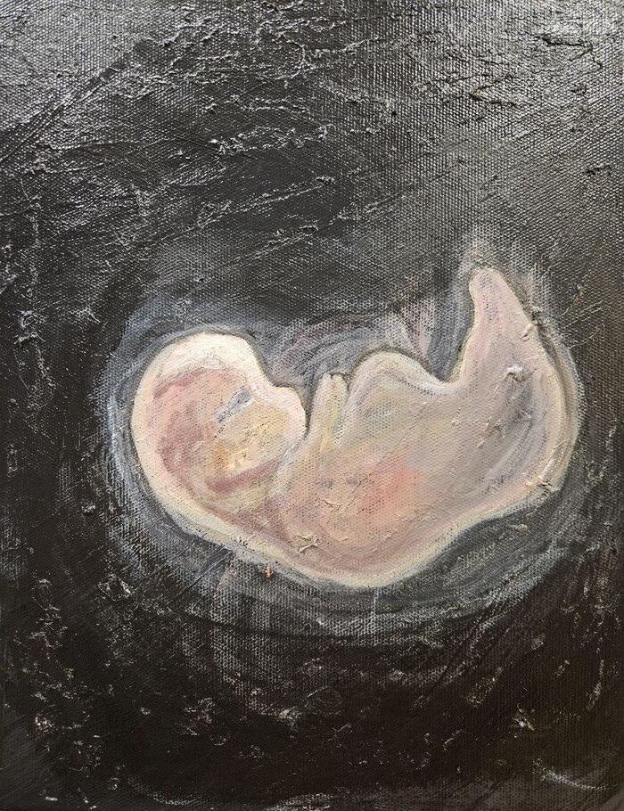 Холст , акрил . Тут моя боль .