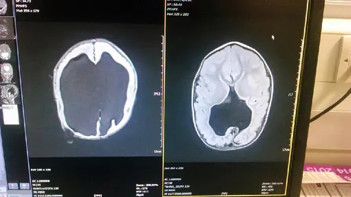 ������� ��� ����� ��������� ���� ����� �������� (�����) � ����� ��������� ��� (������)