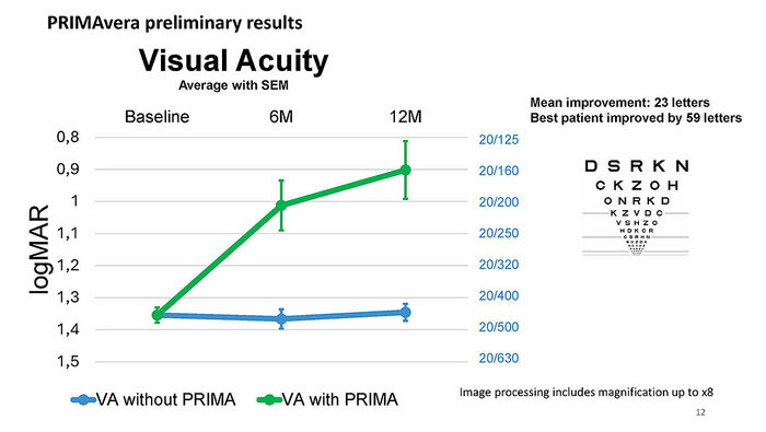 ������ ��������� ������� ������ � ������������ PRIMAVera: ����� ����� � ��� ��������, ������� � � PRIMA (������� ������� 23�25 ���� ETDRS)
