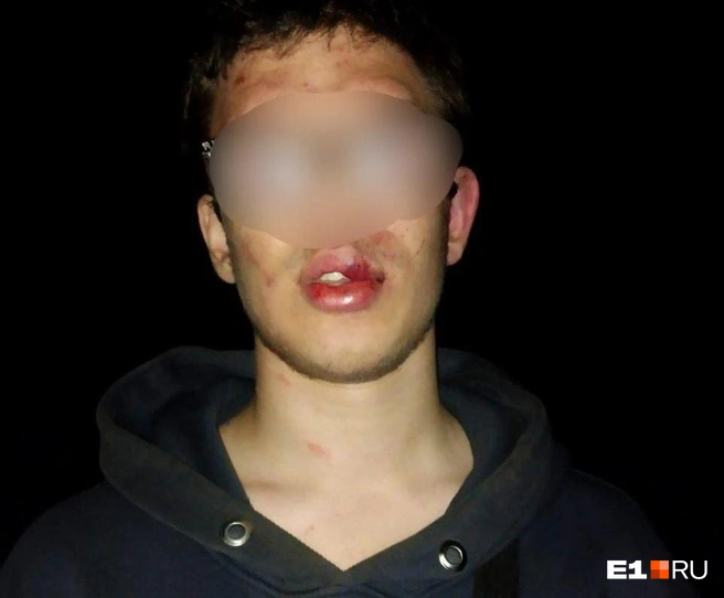 ����� ������� ���� ��������: �������� <!--noindex--><a href="https://pikabu.ru/story/a_chto_tak_mozhno_byilo_sverdlovskiy_deputat_izbil_podrostka_raskayalsya__i_ostalsya_na_svobode_13886268?u=http%3A%2F%2F%D0%951.RU&t=%D0%951.RU&h=47f893d230365dbdb245adab3316ee19f5219afa" title="http://�1.RU" target="_blank" rel="nofollow noopener">�1.RU</a><!--/noindex-->