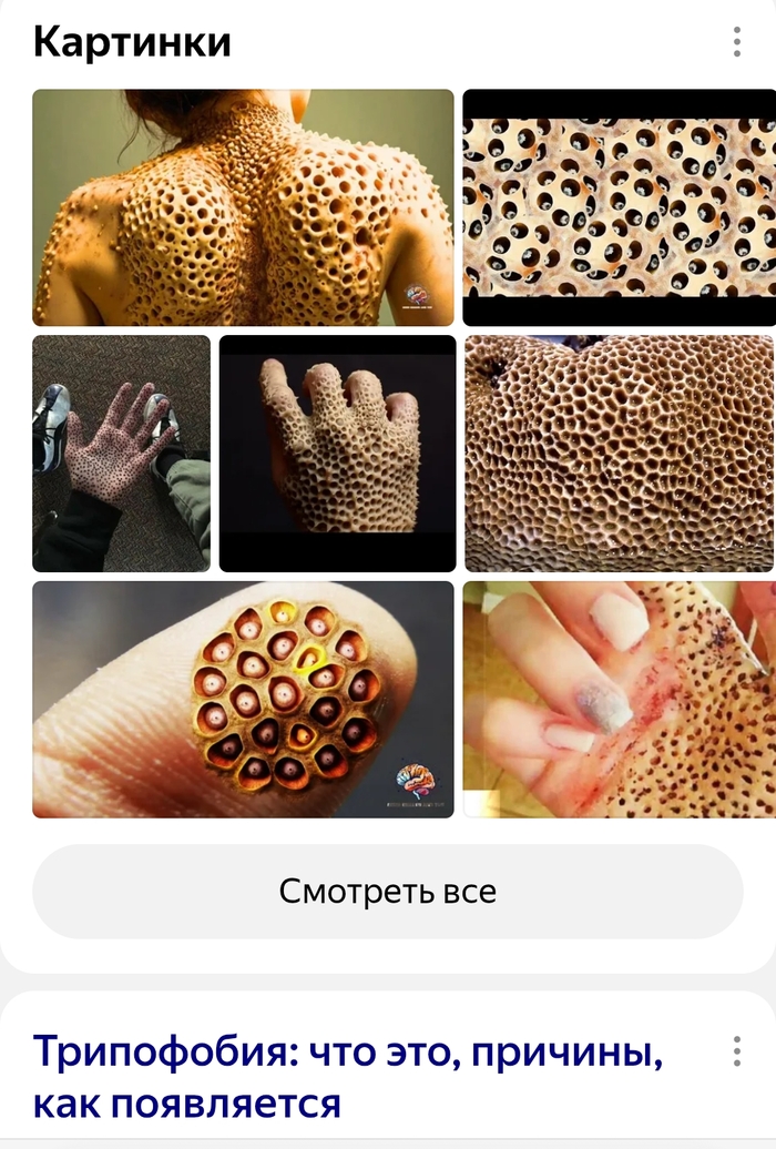 А у вас есть такая шиза?