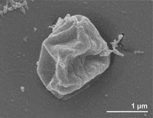 <a href="https://pikabu.ru/story/kak_bakterii_vyizhivayut_pri_temperature_kipeniya_14079281?u=https%3A%2F%2Fwww.researchgate.net%2Ffigure%2FScanning-electron-micrograph-of-P-fumarii-1AT_fig2_51614525&t=%D0%A1%D0%BD%D0%B8%D0%BC%D0%BE%D0%BA&h=5933cb5699e47d5f0bf8a694c93b88dc106bb6fd" title="https://www.researchgate.net/figure/Scanning-electron-micrograph-of-P-fumarii-1AT_fig2_51614525" target="_blank" rel="nofollow noopener">Снимок</a> Pyrolobus fumarii полученный с помощью электронного сканирующего микроскопа