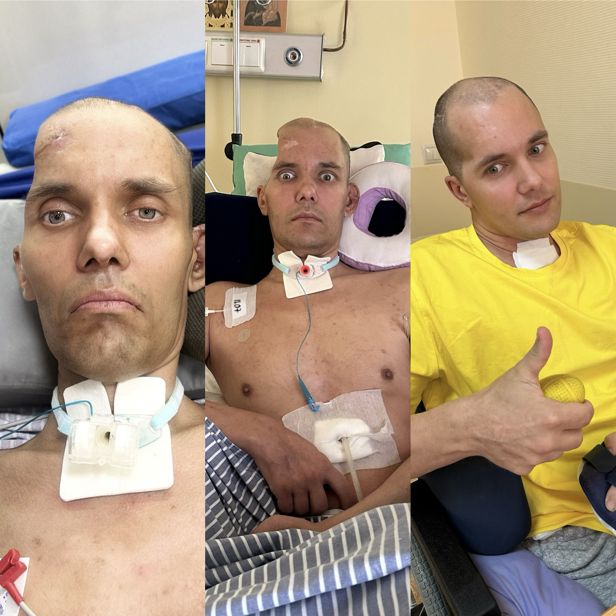 I won't give up and I won't let you or the story of the fight for my husband's life. The Wives Project - Series Project Wives, My, Longpost, Wife, Russian spirit, Regina, Disease history, Injury, Treatment, Surgery, Operation, Video, Vertical video, Short videos, Rutube