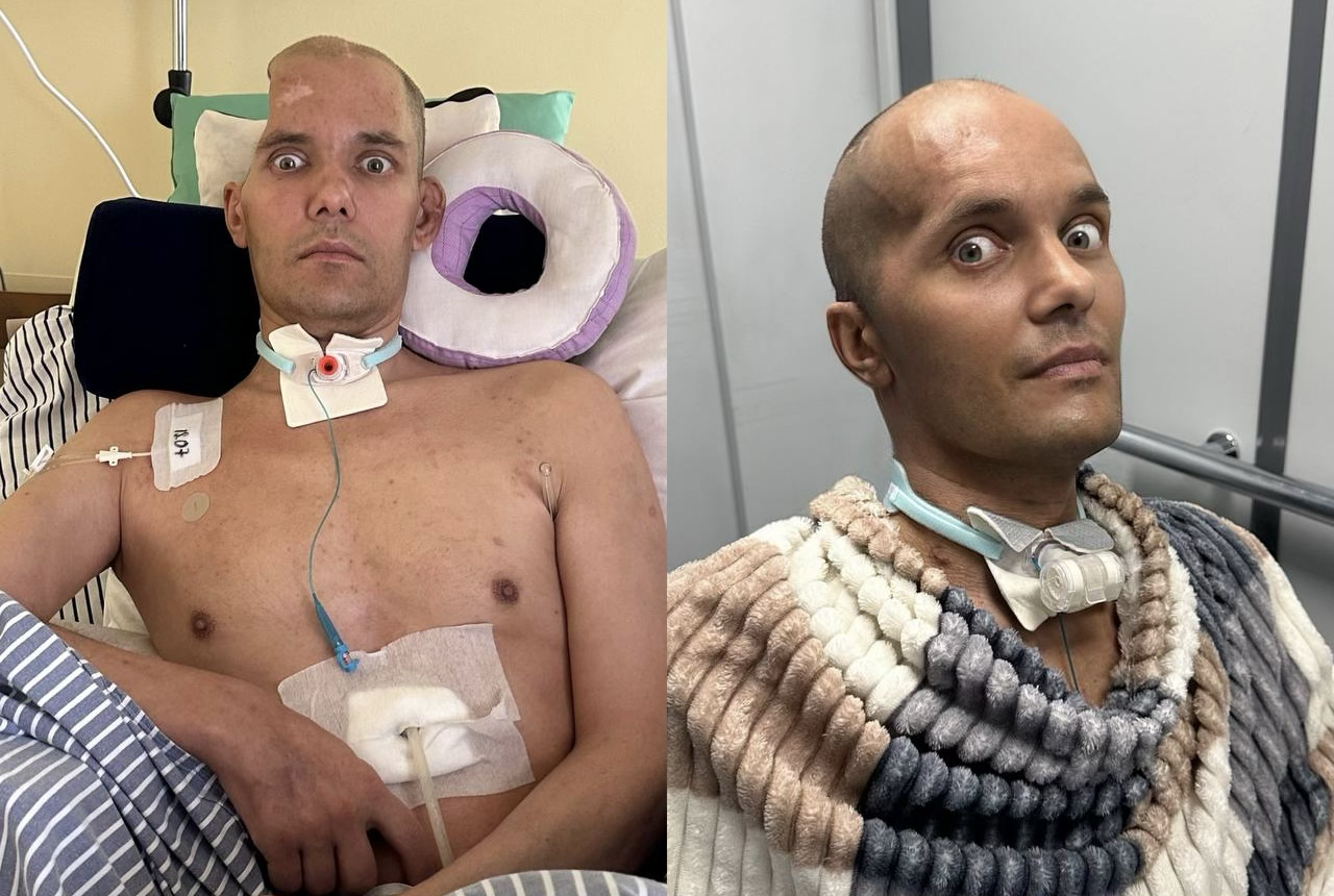 I won't give up and I won't let you or the story of the fight for my husband's life. The Wives Project - Series Project Wives, My, Longpost, Wife, Russian spirit, Regina, Disease history, Injury, Treatment, Surgery, Operation, Video, Vertical video, Short videos, Rutube