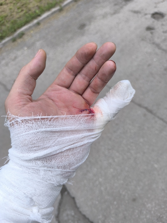 Покусали