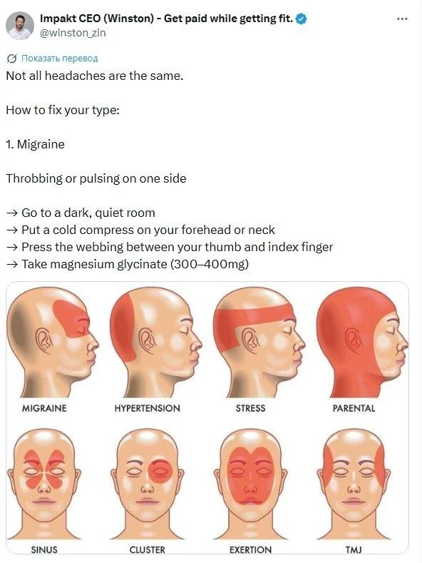 We learn to recognize and eliminate any migraine - Migraine, Head, Telegram (link), , Peekaboo+