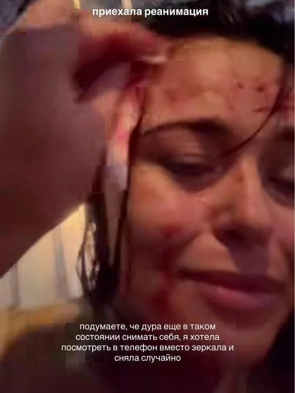 Sober this time. A beautiful blogger from Yekaterinburg crashed her scooter, with blood gushing from her head. - Series Articles from the web, Negative, Incident, Injury, Electric scooter, Scooters, Kick scooter, Yekaterinburg, Longpost