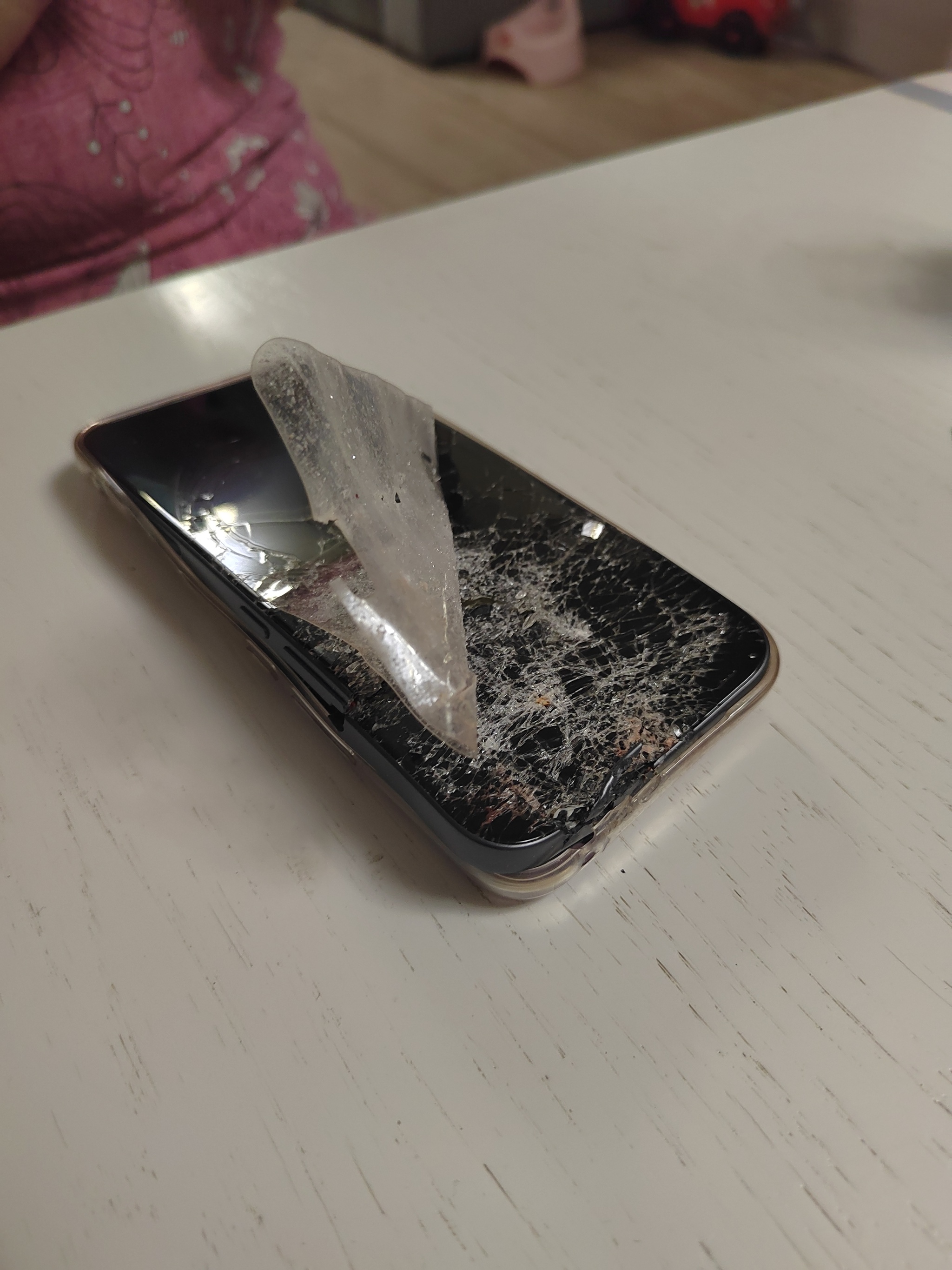 A small but life lesson - My, Carelessness, Crash, Manicure, take care of yourself, Longpost