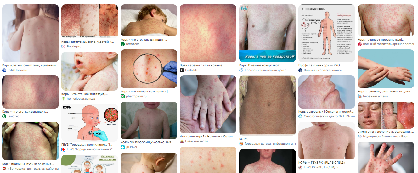 Reply to the post No, that's nonsense - Series Tyoma explains about medicine, Humor, Measles, Anti-vaccines, A wave of posts, Telegram (link), Screenshot, Reply to post, Longpost