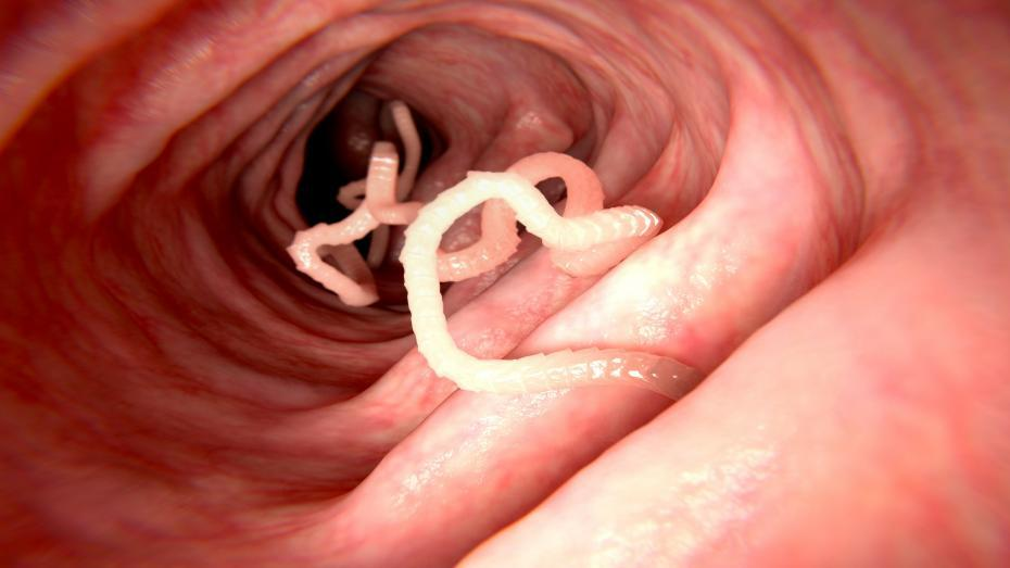 Where do allergies come from and what do worms have to do with it? - My, Nauchpop, Health, Worms, Allergy, Immunity, Free translation, Video, Youtube, Longpost
