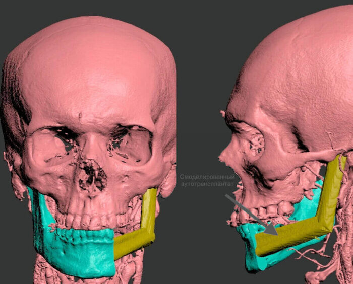 Этап 3D моделирования
